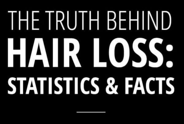 The Truth Behind Hair Loss_ Statistics and Facts - KSL Clinics UK