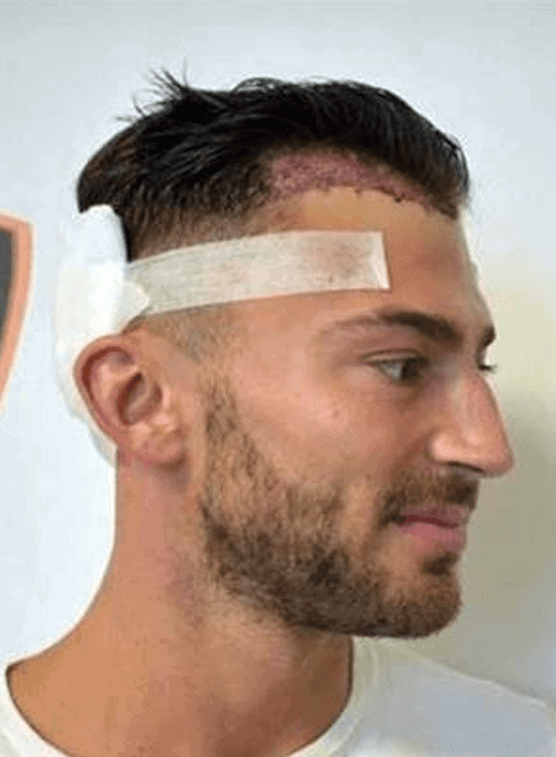Jake Quickenden post surgery