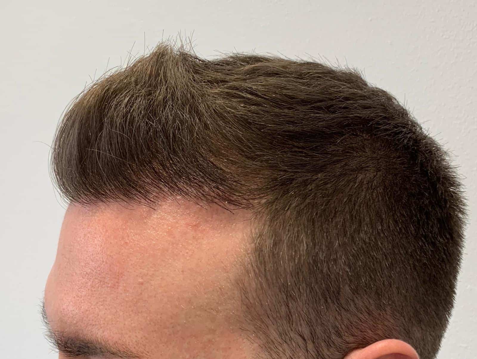 Hair Brained Questions