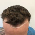 Warren hairline drawn e1544629920587