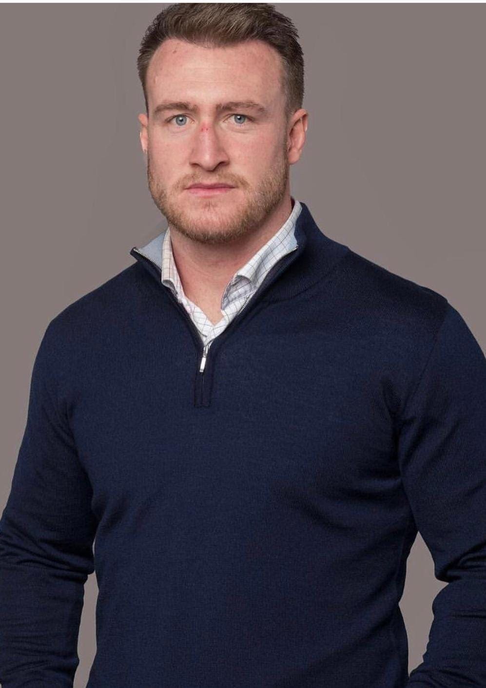 Rugby Union player, Stuart Hogg transforms his Hairline with us at KSL Clinic