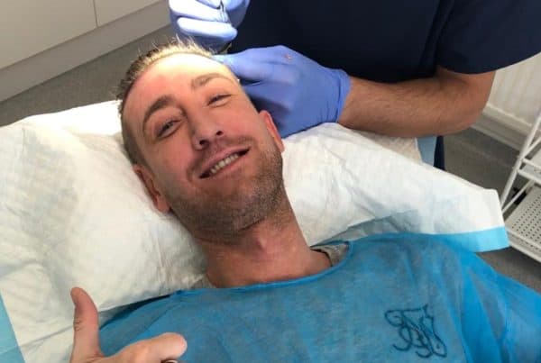 Man's FUE Hair Transplants VS Laser Hair Restoration appointment update