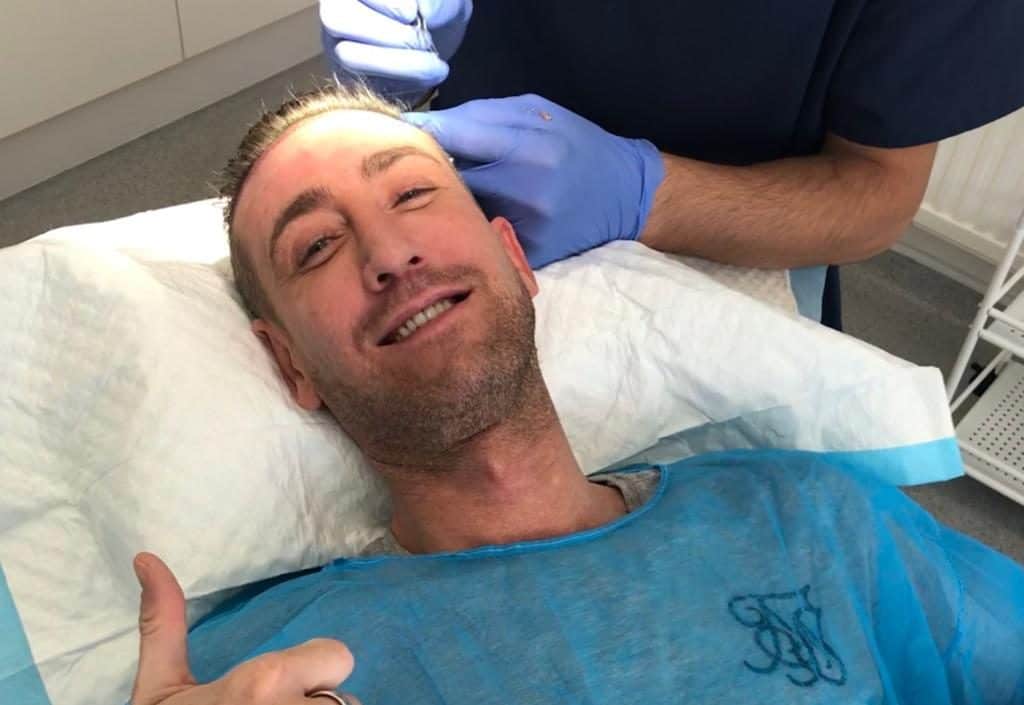 Man's FUE Hair Transplants VS Laser Hair Restoration appointment update