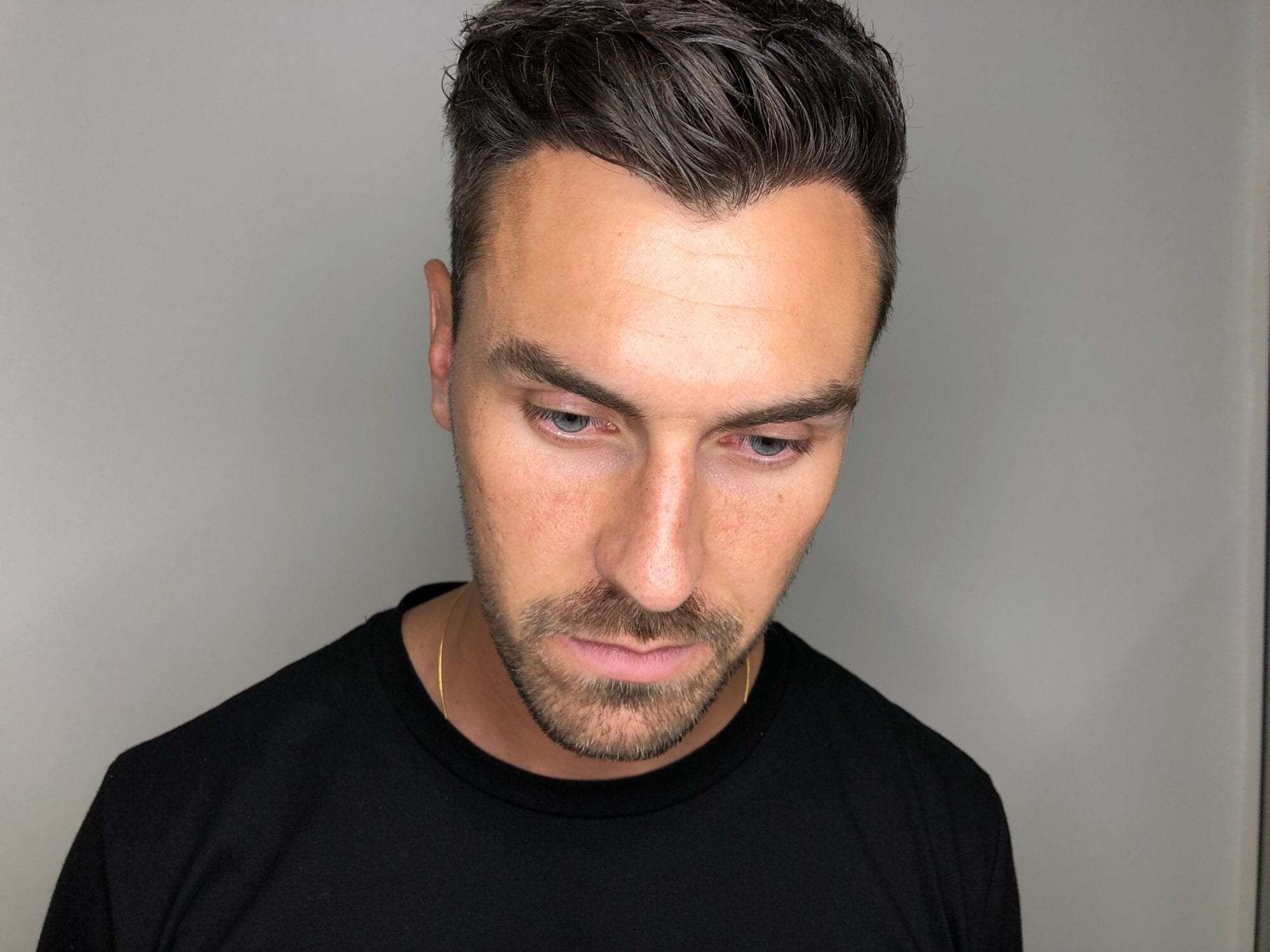 Grant Hall visits the KSL Clinic for his 1 year review and  PRP Injections