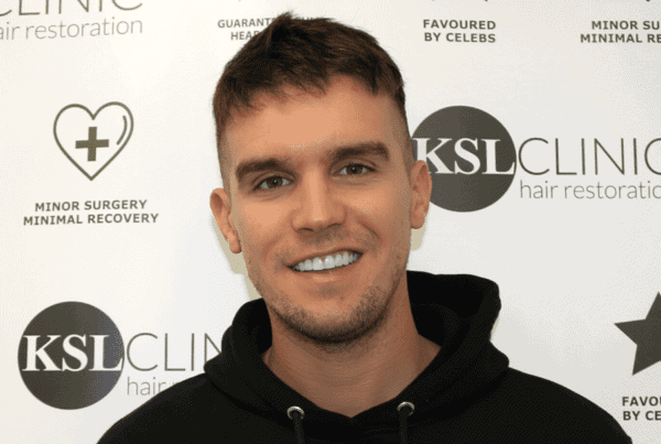 KSL hair transplant