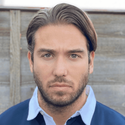 KSL hair transplant