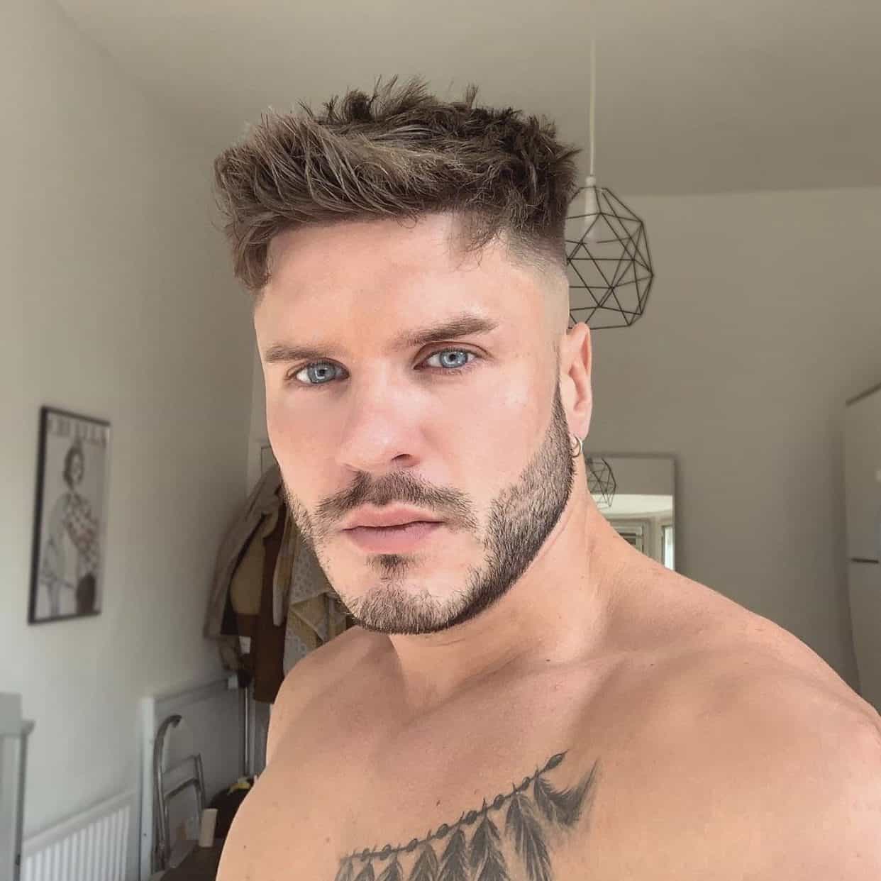KSL hair transplant