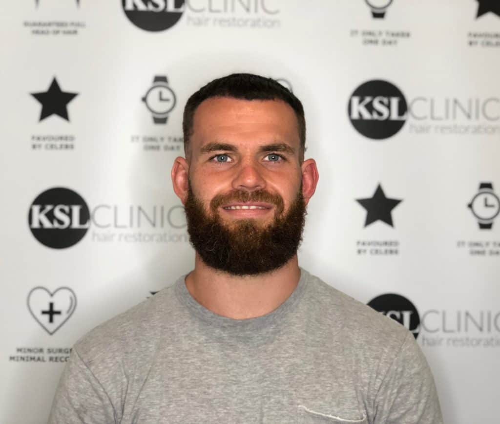 KSL hair transplant