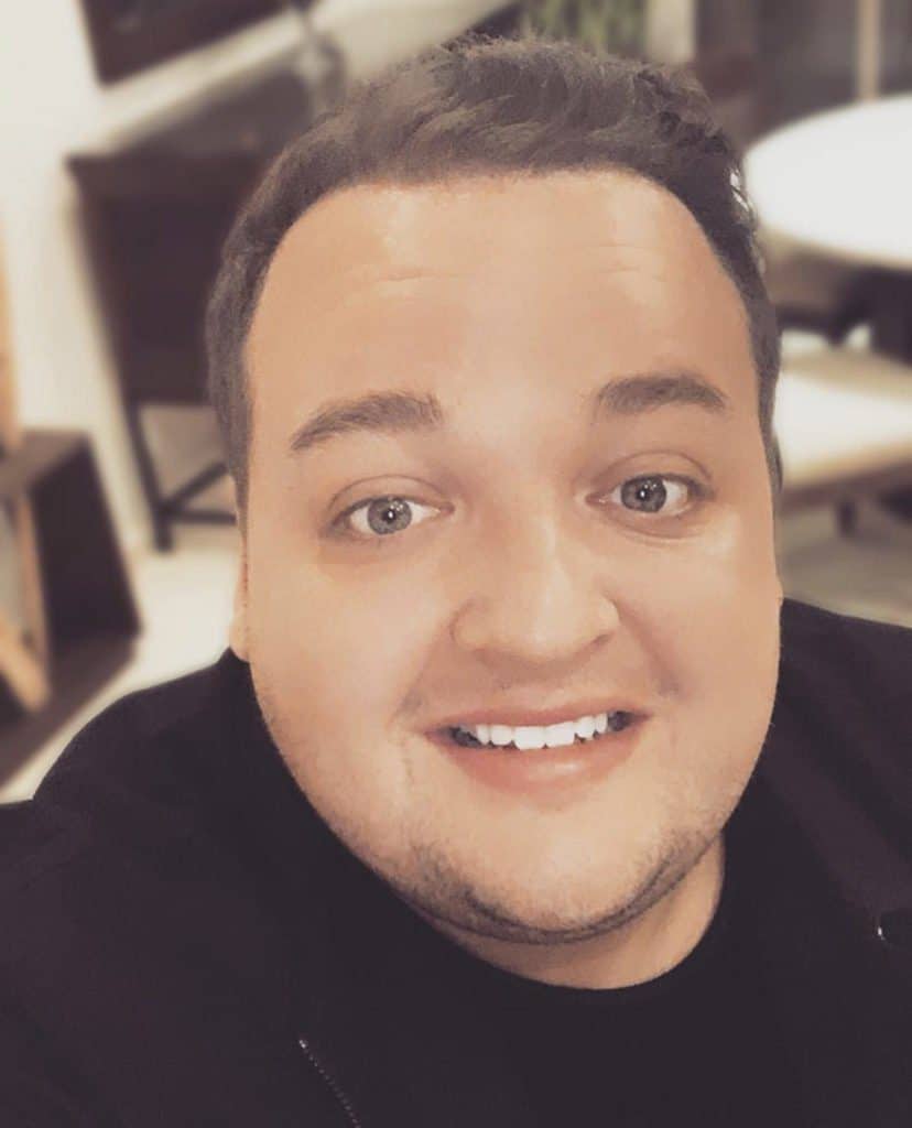 KSL hair transplant