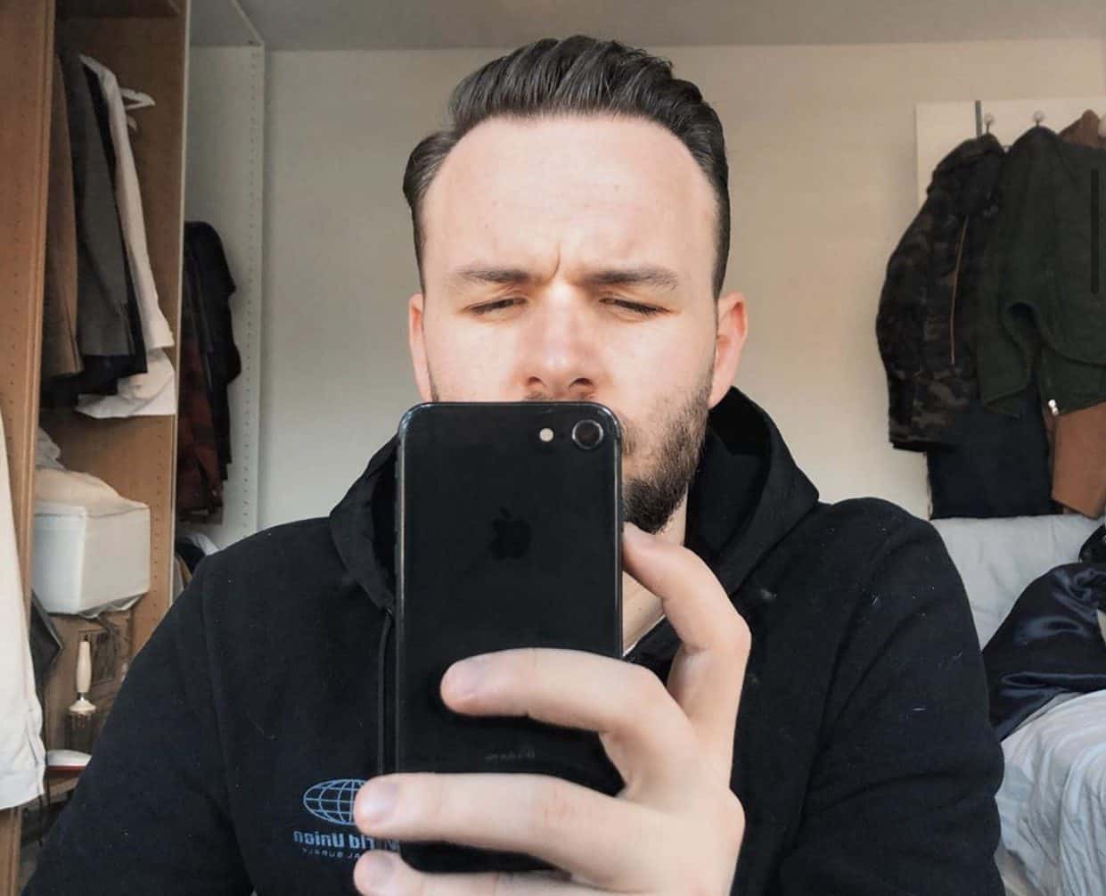 KSL hair transplant