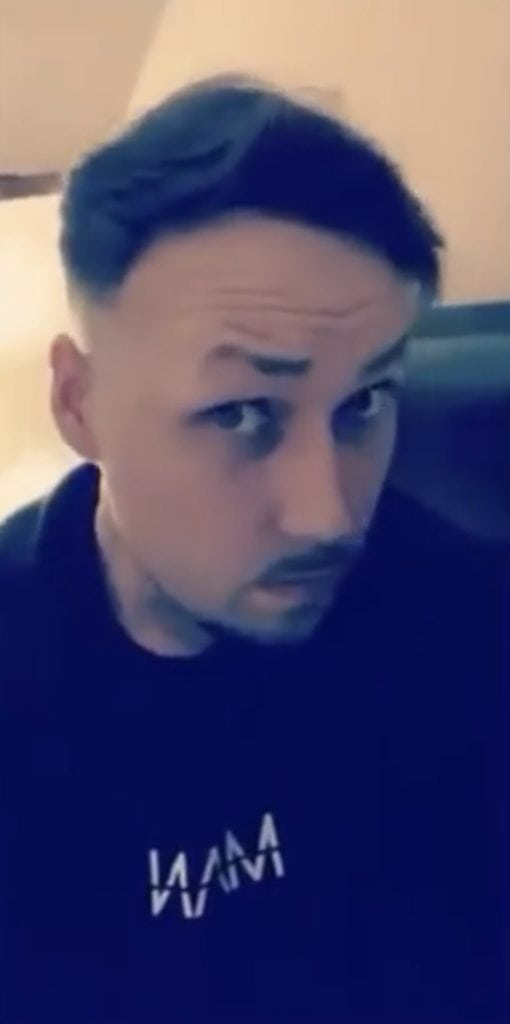 KSL hair transplant