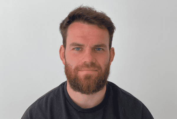 KSL hair transplant