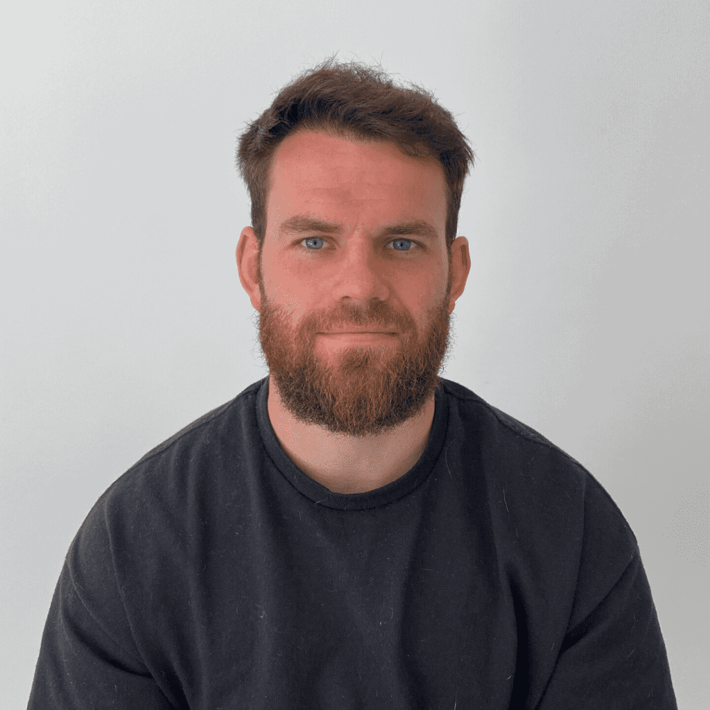 KSL hair transplant