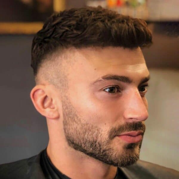 KSL hair transplant
