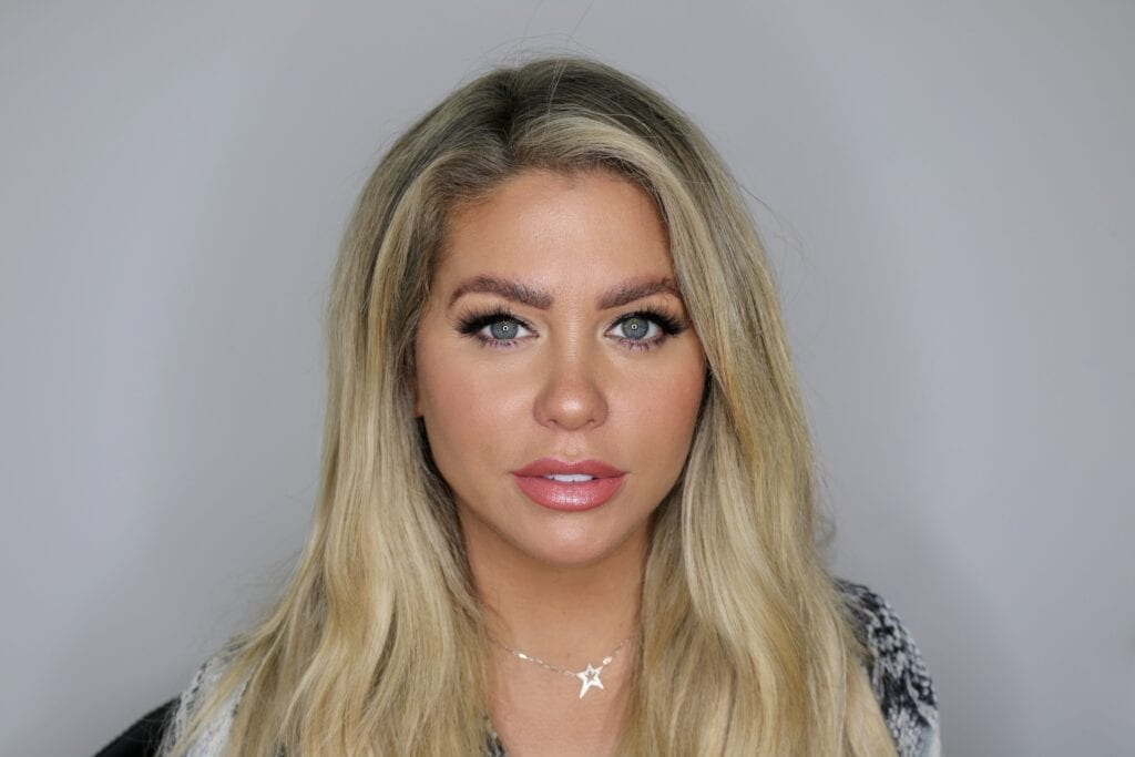 hair transplants for women