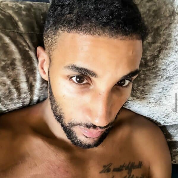 KSL-Clinic-Hair-Transplant