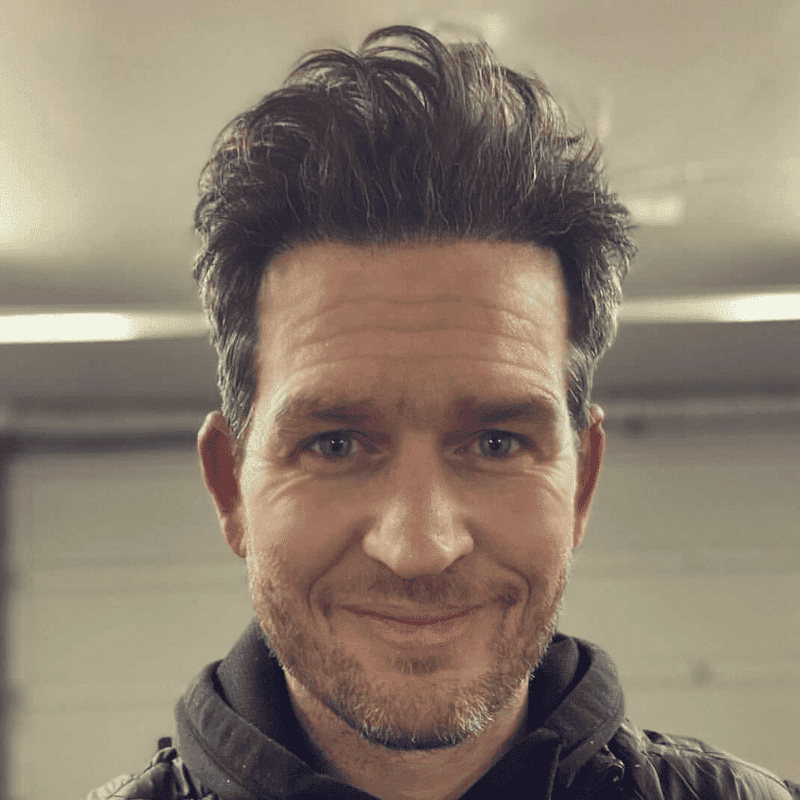 KSL-Clinic-Hair-Transplant