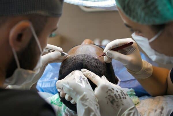 Is a Hair Transplant Painful