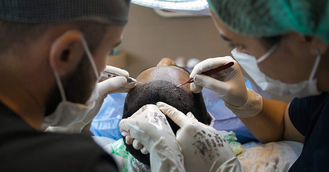 Is a Hair Transplant Painful?