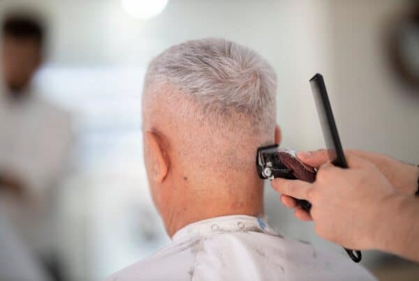 do i need to shave hair for hair transplant