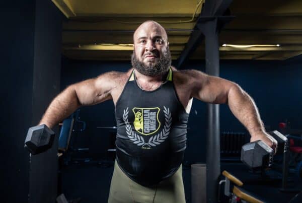 does testosterone cause hair loss