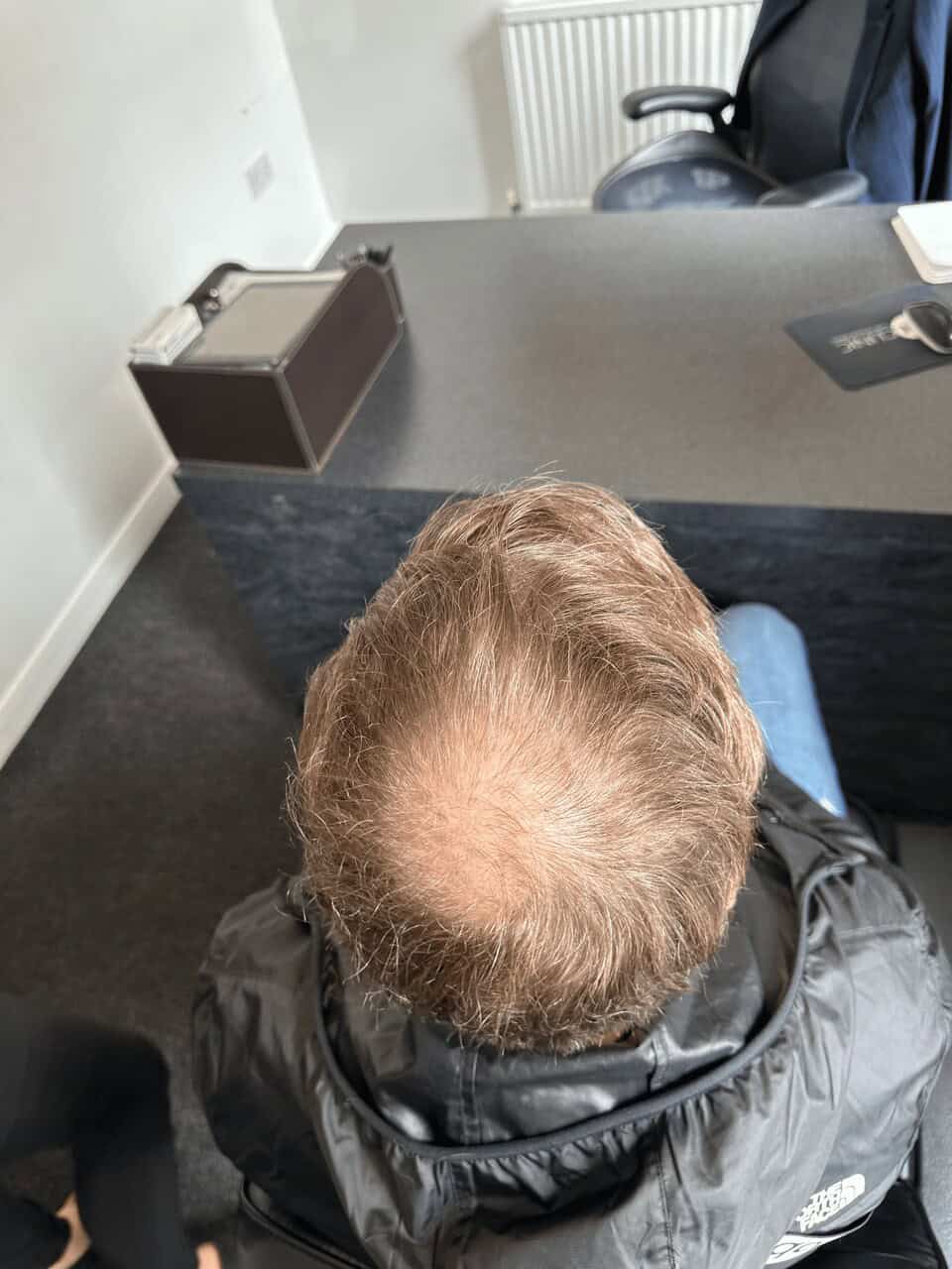 PRP before and after 2