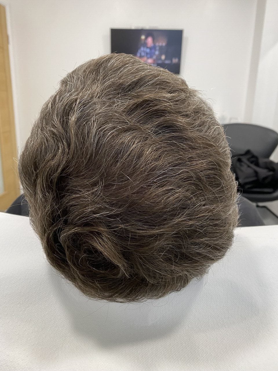 PRP before and after 5.jpg