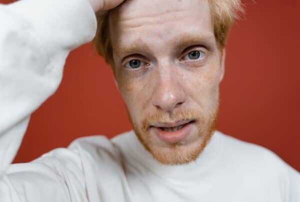 hair transplant for ginger hair