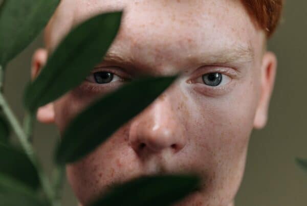 thin eyebrows male transplant