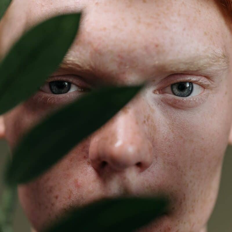 thin eyebrows male transplant