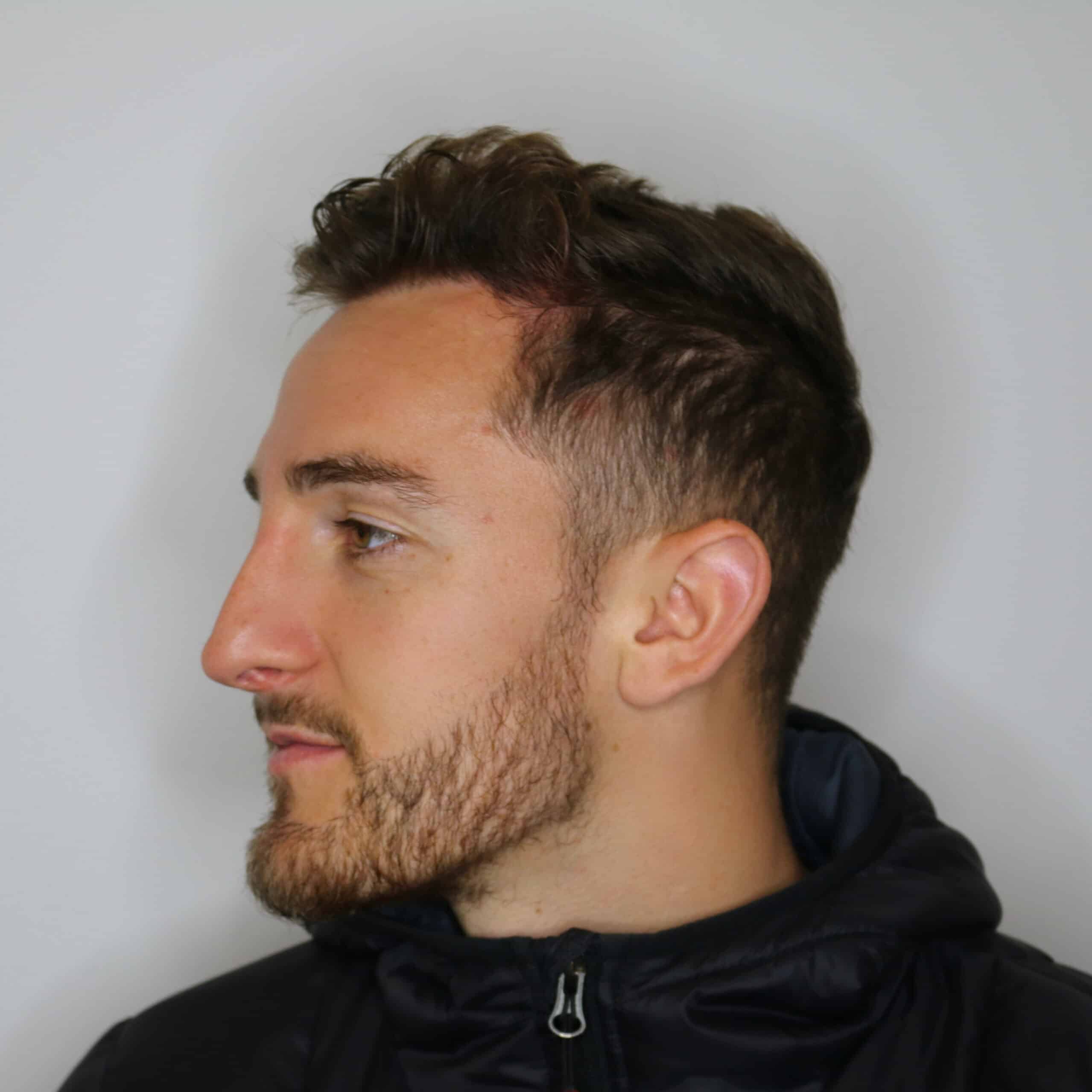 3df5fd4d 7008 403d a4d2 000dc188c982