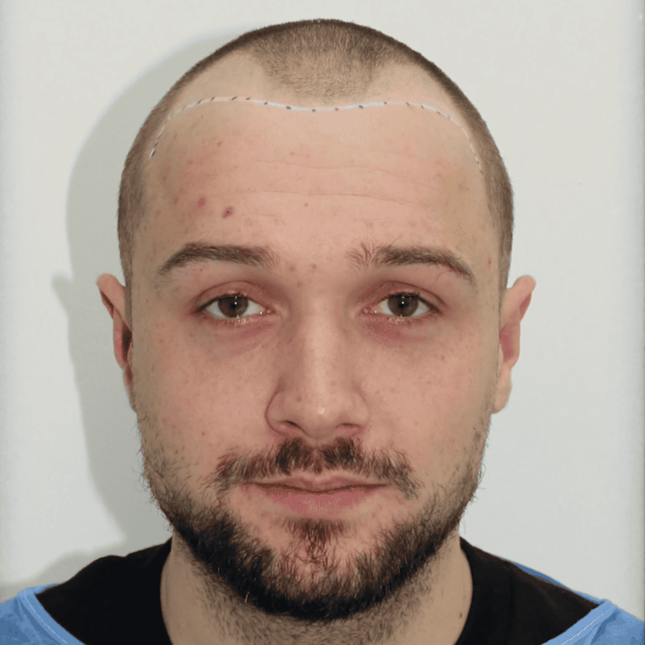 863c8c22 afb8 4b4a 91fe ca1dd8019440