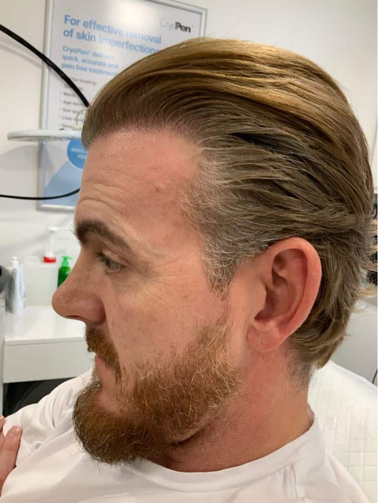 photo dgytwB $1$4rJZ.jJ5$dh8zfb00dHOgFQ4744Cii$1$3pdiLGs6$9tm3WcWye1IMYNRBp8Y1