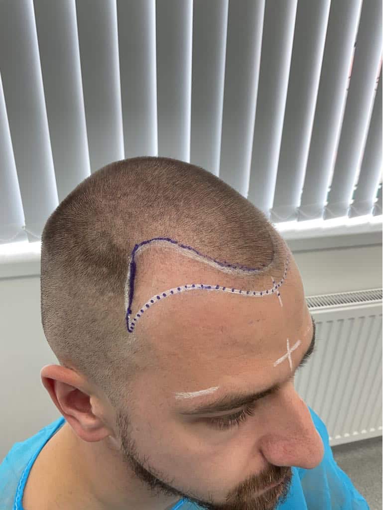 photo IDUoIQ $1$9oPNG1q$.Rtrainzp0jdHiazImJO$1$lmwStPM$pFjKfnOQcoPDKW2qELSK.