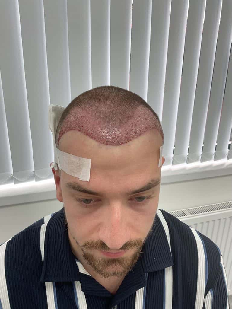 photo Lmbslr $1$3DeBZ56n$mGNpDWCeruX0MCkrW7Iy1$1$O9tStylv$NGEc5n8XXlWU0bhaQZz.