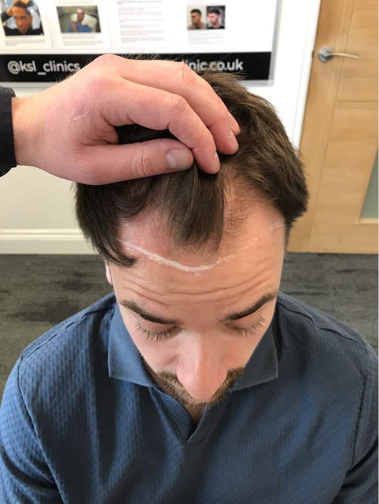 photo TttHdc $1$C6e7mX3P$9kG9c8m.3XdYH2Yu8SKUm1$1$OBvruqay$Xqv4CGqQ0bs3KUzcwP2hL