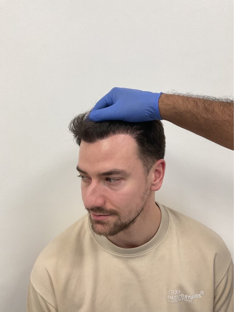 photo bqpzgL $1$aChYcjSz$Ya.DYcxP84k68ycxAJJS8$1$YhnR02il$aaKAbiqpYo6PmyWT6Gfge.