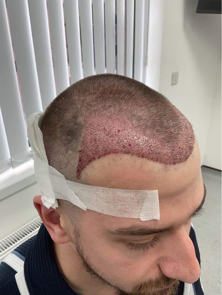 photo qsxGfh $1$8F1npsy$im1004hxlpokSjVpSzqKs.$1$Xfg1ZpVi$zPQzue3Ga7yuWBJsY3aC.