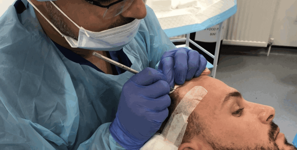 what technology do we use for hair transplants (1)