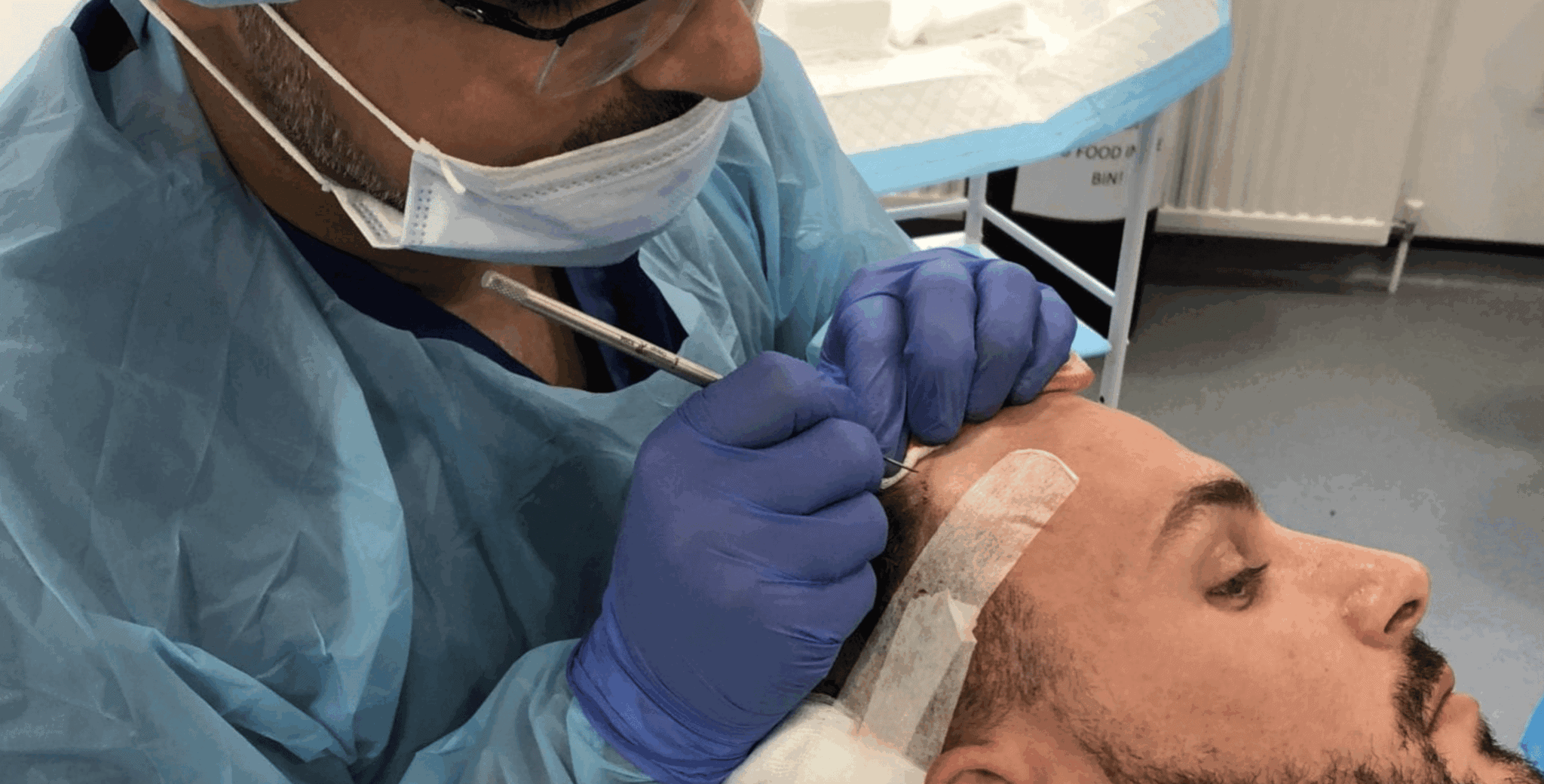 What Technology Do We Use for Hair Transplants?