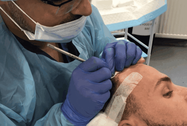 what technology do we use for hair transplants (1)
