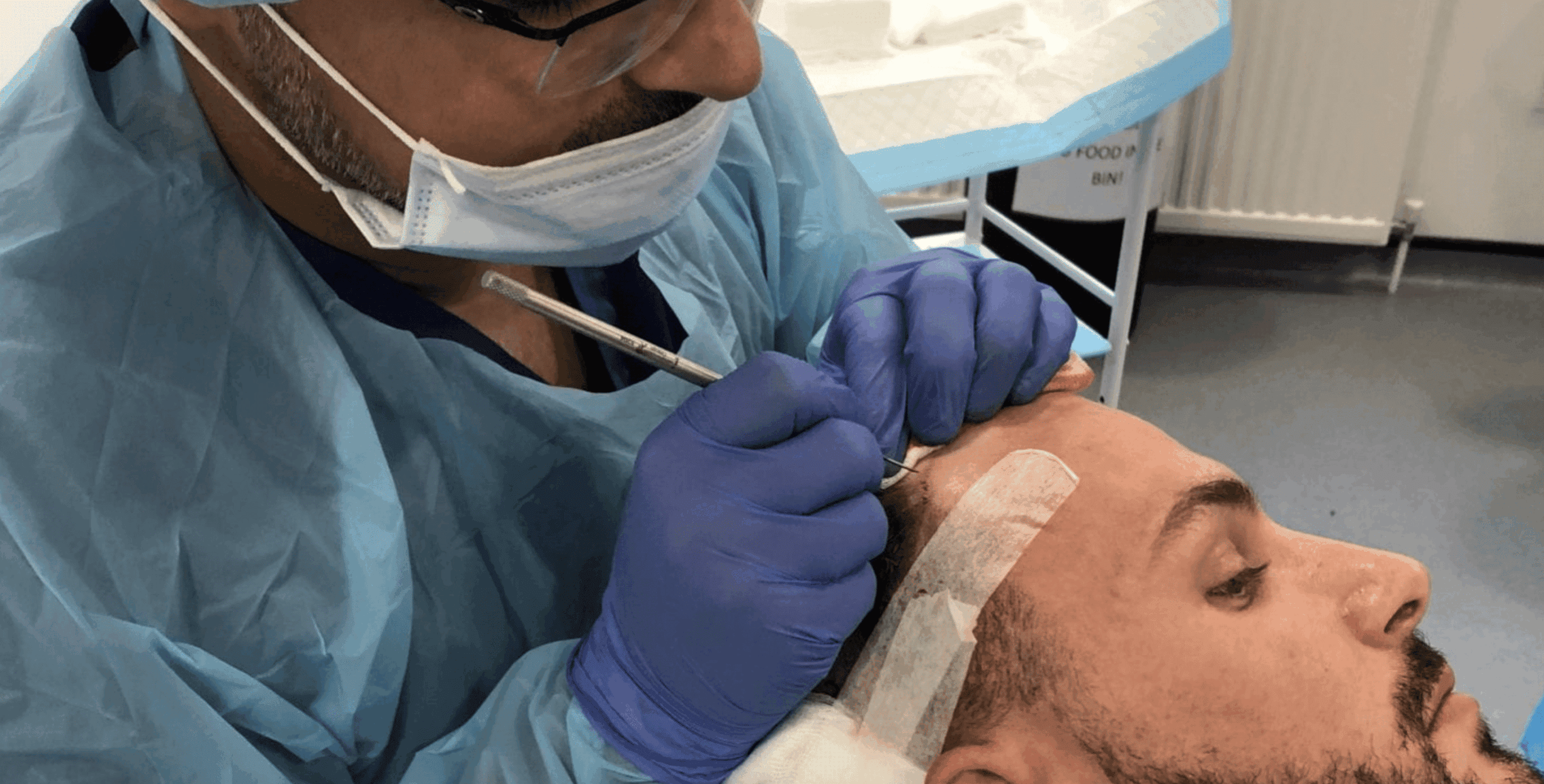 What Technology Do We Use for Hair Transplants?