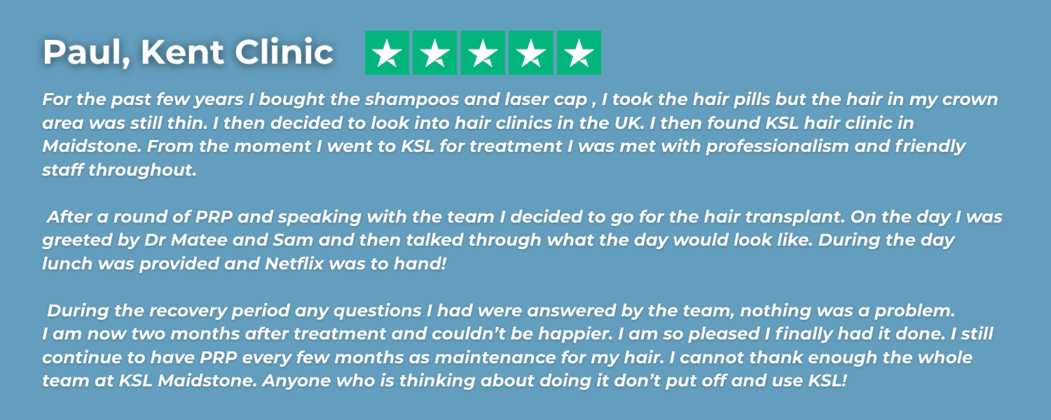 Review thinning hair in 30s