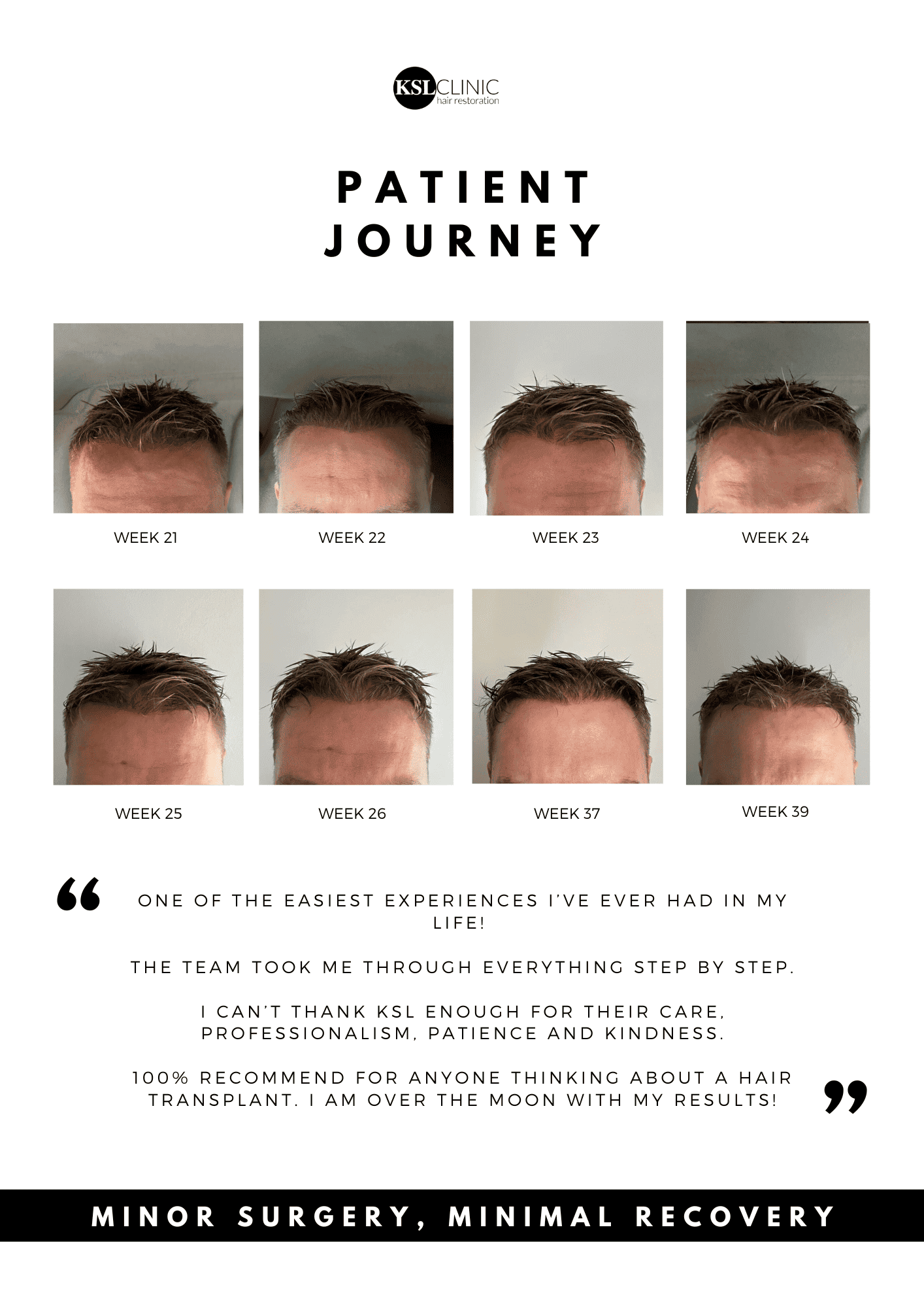 a timeline showing hair transplant recovery