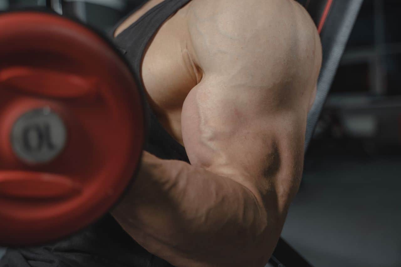 Do Steroids Cause Baldness?
