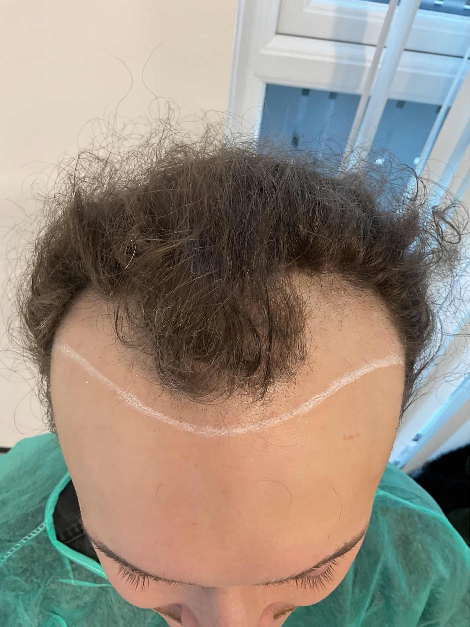 Kyran Thrax Surgery
