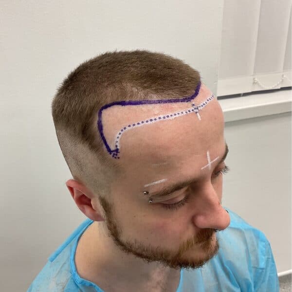 Ashley Surgery