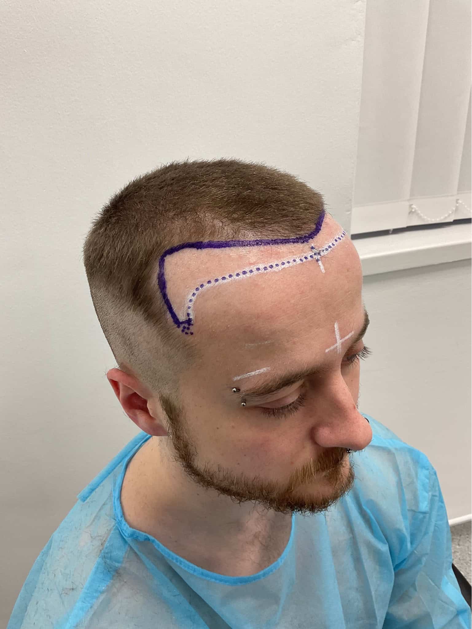 Ashley Surgery