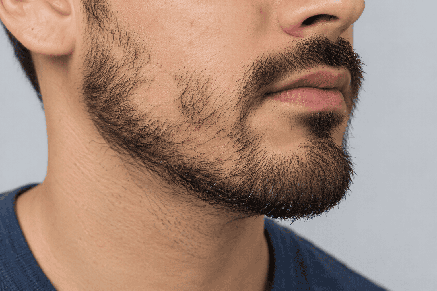 Bald Spot on Facial Hair
