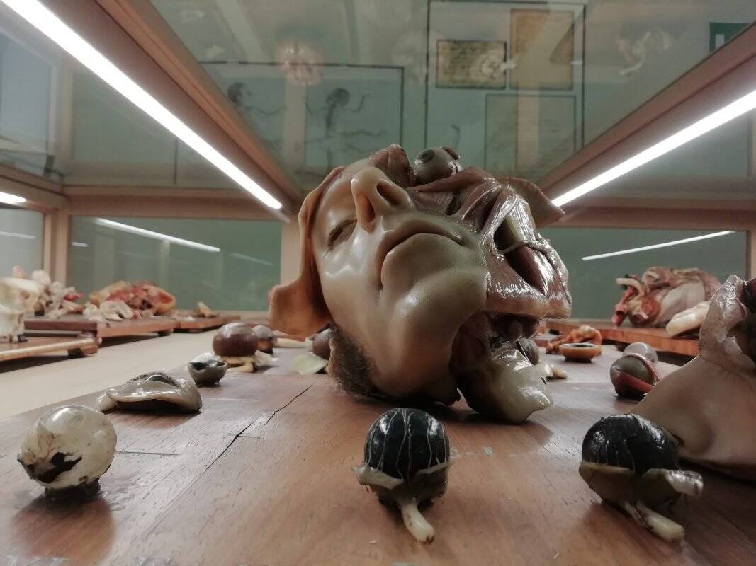 Museo Delle Cere Anatomiche Bologna